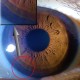 Simple Iris Condition Checker Simple Iris Condition Checker