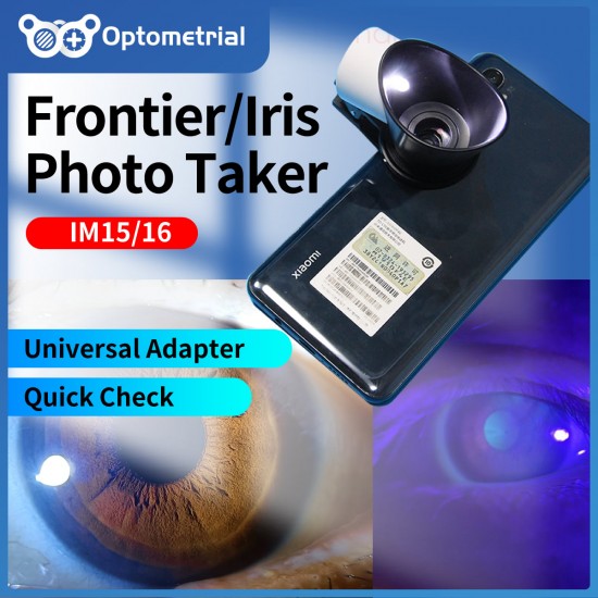 Simple Iris Condition Checker Simple Iris Condition Checker