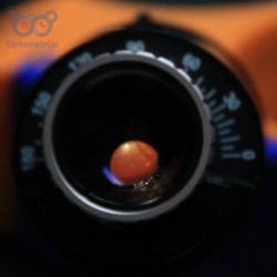 Rechargeable Direct Ophthalmoscope HS-OP10-C