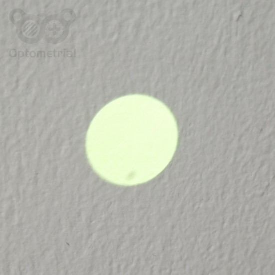 Direct Ophthalmoscope OP-10