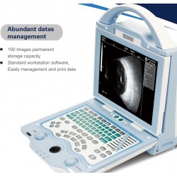 Ophthalmology AB Ultrasonic Scanner OPH50B