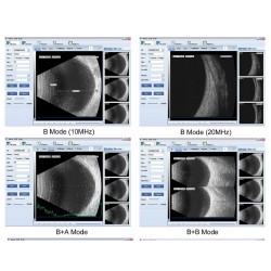 Ophthalmology AB Ultrasonic Scanner SW-2100